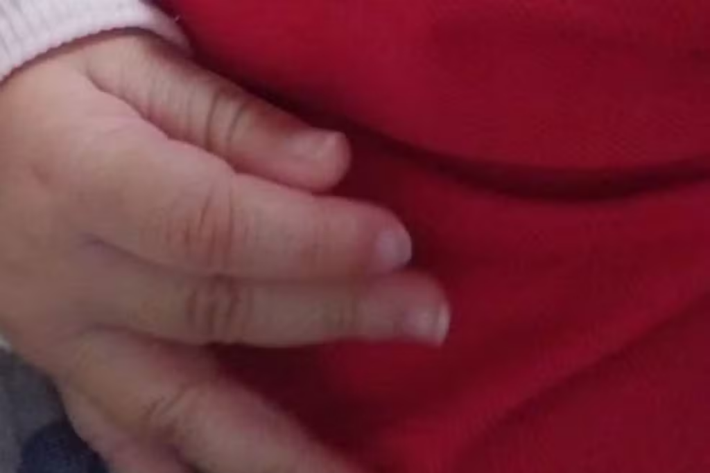 Mãe é presa em Nova Andradina suspeita de agredir bebê de 7 meses com lesão no crânio