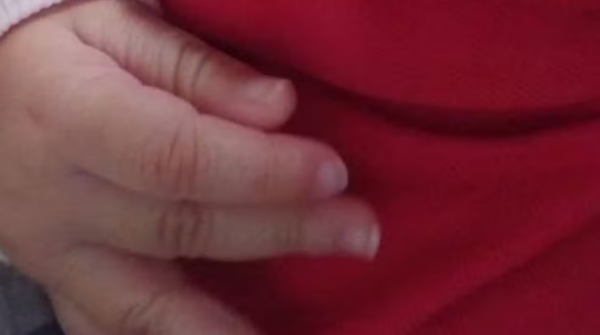 Mãe é presa em Nova Andradina suspeita de agredir bebê de 7 meses com lesão no crânio